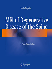 MRI of Degenerative Disease of the Spine