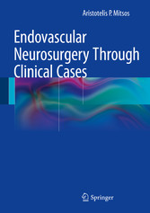 Endovascular Neurosurgery Through Clinical Cases