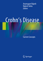 Crohn's Disease