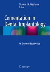 Cementation in Dental Implantology