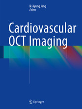 Cardiovascular OCT Imaging