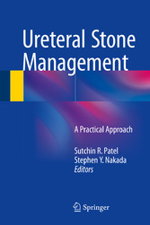 Ureteral Stone Management