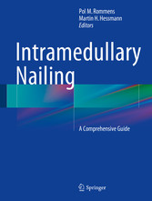 Intramedullary Nailing