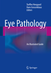 Eye Pathology