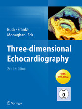 Three-dimensional Echocardiography