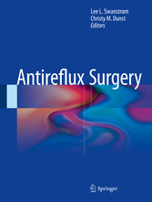 Antireflux Surgery