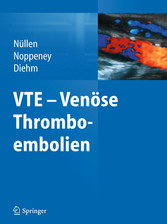 VTE - Venöse Thromboembolien