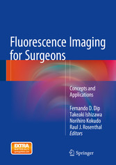 Fluorescence Imaging for Surgeons