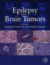 Epilepsy and Brain Tumors