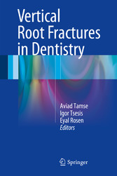 Vertical Root Fractures in Dentistry