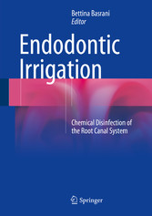 Endodontic Irrigation