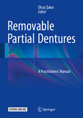 Removable Partial Dentures