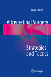 Vitreoretinal Surgery: Strategies and Tactics