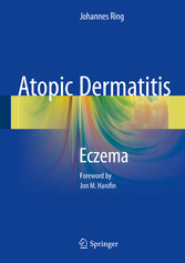 Atopic Dermatitis