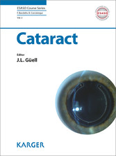 Cataract