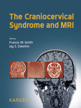 The Craniocervical Syndrome and MRI