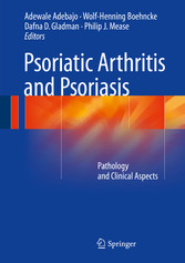 Psoriatic Arthritis and Psoriasis