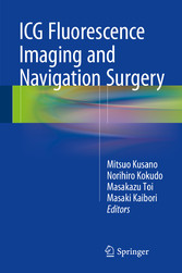 ICG Fluorescence Imaging and Navigation Surgery