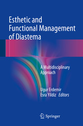 Esthetic and Functional Management of Diastema