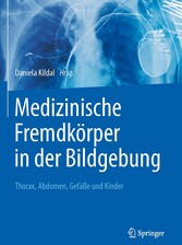 Medizinische Fremdkörper in der Bildgebung