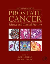 Prostate Cancer