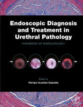 Endoscopic Diagnosis and Treatment in Urethral Pathology