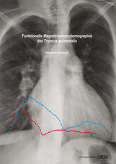 Funktionelle Magnetresonanztomographie des Truncus pulmonalis