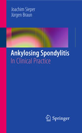 Ankylosing Spondylitis