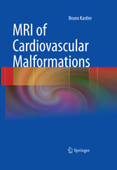 MRI of Cardiovascular Malformations