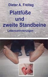 Plattfüße und zweite Standbeine