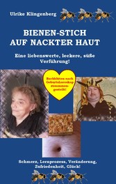 Bienen - Stich auf nackter Haut