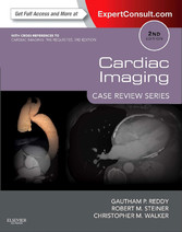 Cardiac Imaging: Case Review Series