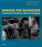 Making the Diagnosis: A Practical Guide to Breast Imaging