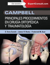 Campbell. Principales procedimientos en cirugía ortopédica y traumatología + ExpertConsult