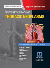 Specialty Imaging: Thoracic Neoplasms