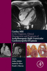 The Cardiac MRI in Diagnosis, Clinical Management, and Prognosis of Arrhythmogenic Right Ventricular Cardiomyopathy/Dysplasia