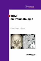 TDM en traumatologie CAMPUS