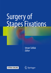 Surgery of Stapes Fixations