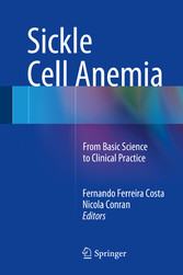 Sickle Cell Anemia