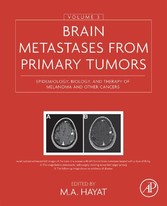 Brain Metastases from Primary Tumors, Volume 3