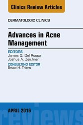 Advances in Acne Management, An Issue of Dermatologic Clinics,