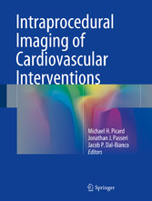 Intraprocedural Imaging of Cardiovascular Interventions