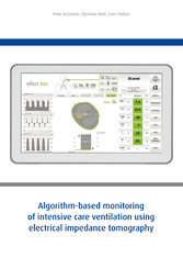 Algorithm-based monitoring of intensive care ventilation using electrical impedance tomography