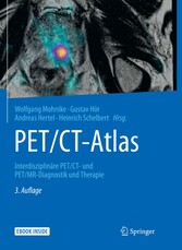 PET/CT-Atlas