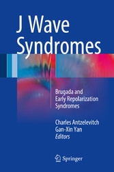 J Wave Syndromes