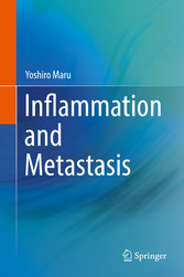 Inflammation and Metastasis