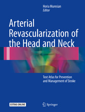 Arterial Revascularization of the Head and Neck