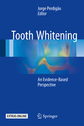 Tooth Whitening