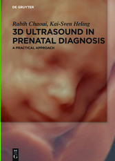 3D Ultrasound in Prenatal Diagnosis