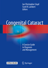 Congenital Cataract